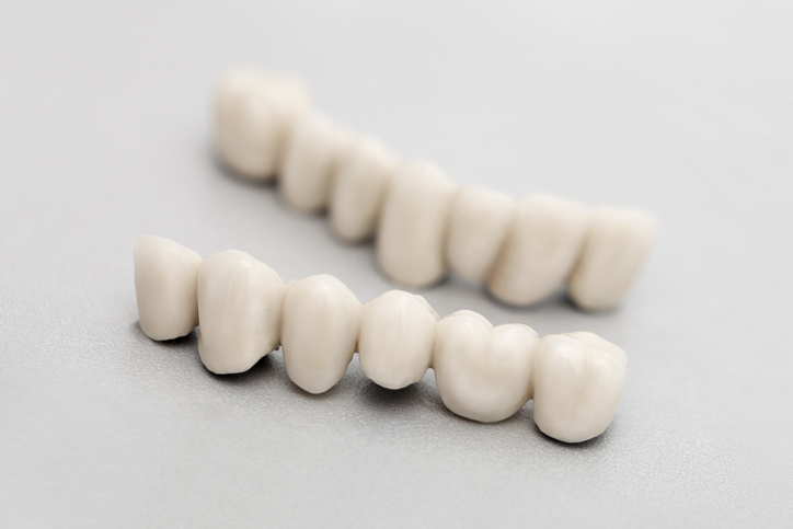 dentystyczne korony porcelanowe