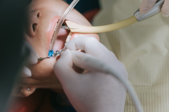 leczenie kanałowe zębów