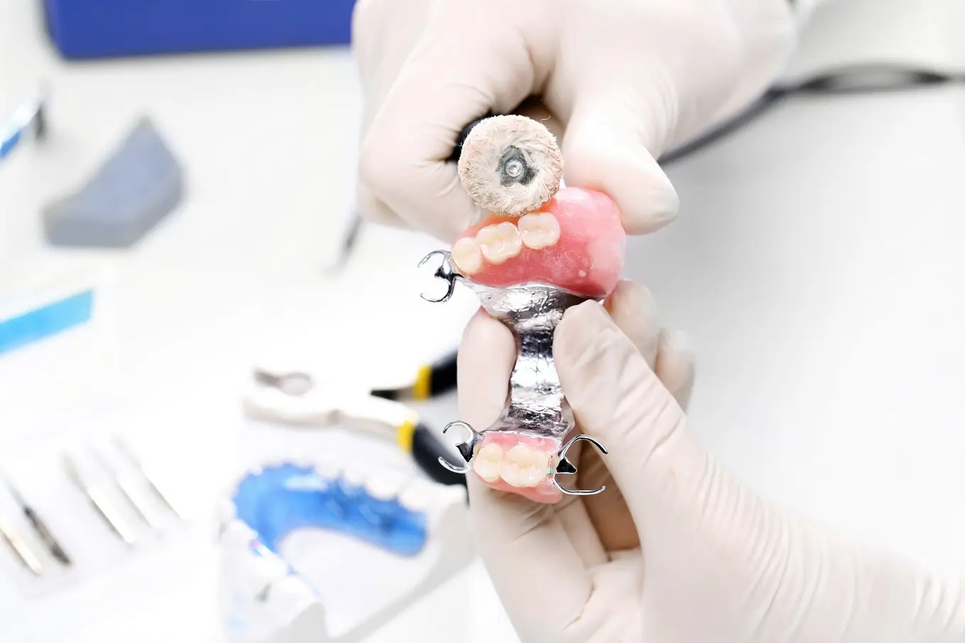 tworzenie protezy zębowej