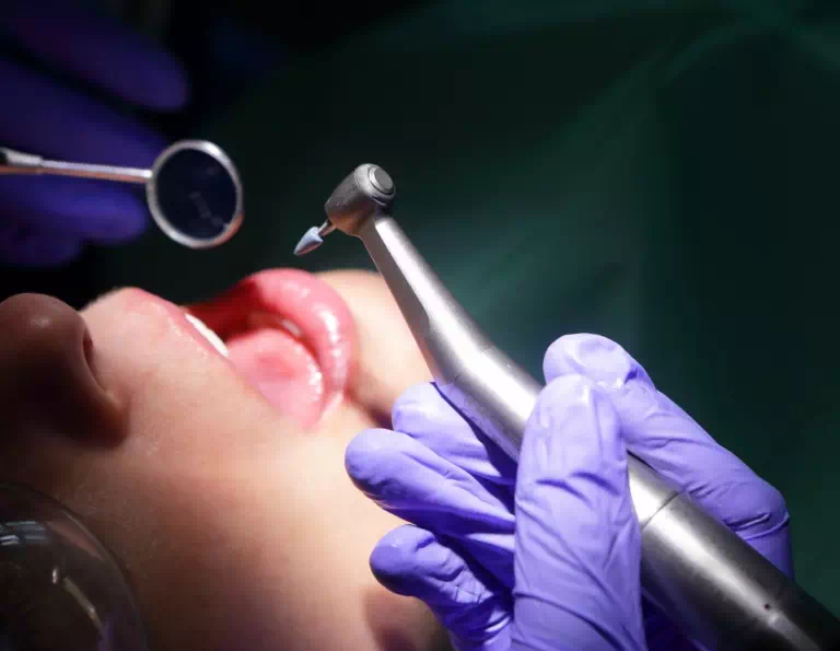 pacjent u dentysty z otwartą buzią
